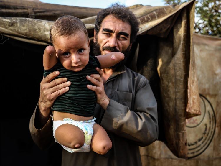 <p>Oğlunun sağa sola dönüp kardeşleri gibi yürümeye çalıştığını ancak başaramadığını görünce çok üzüldüğünü ifade eden Ablo, ''Oğlum yemek yemek için kimseden yardım istemiyor. Başaramayınca da çok ağlıyor. Kendini yerlere vuruyor. Sakinleştirmek için çok çaba sarf ediyoruz.'' şeklinde konuştu.</p>

<p> </p>
