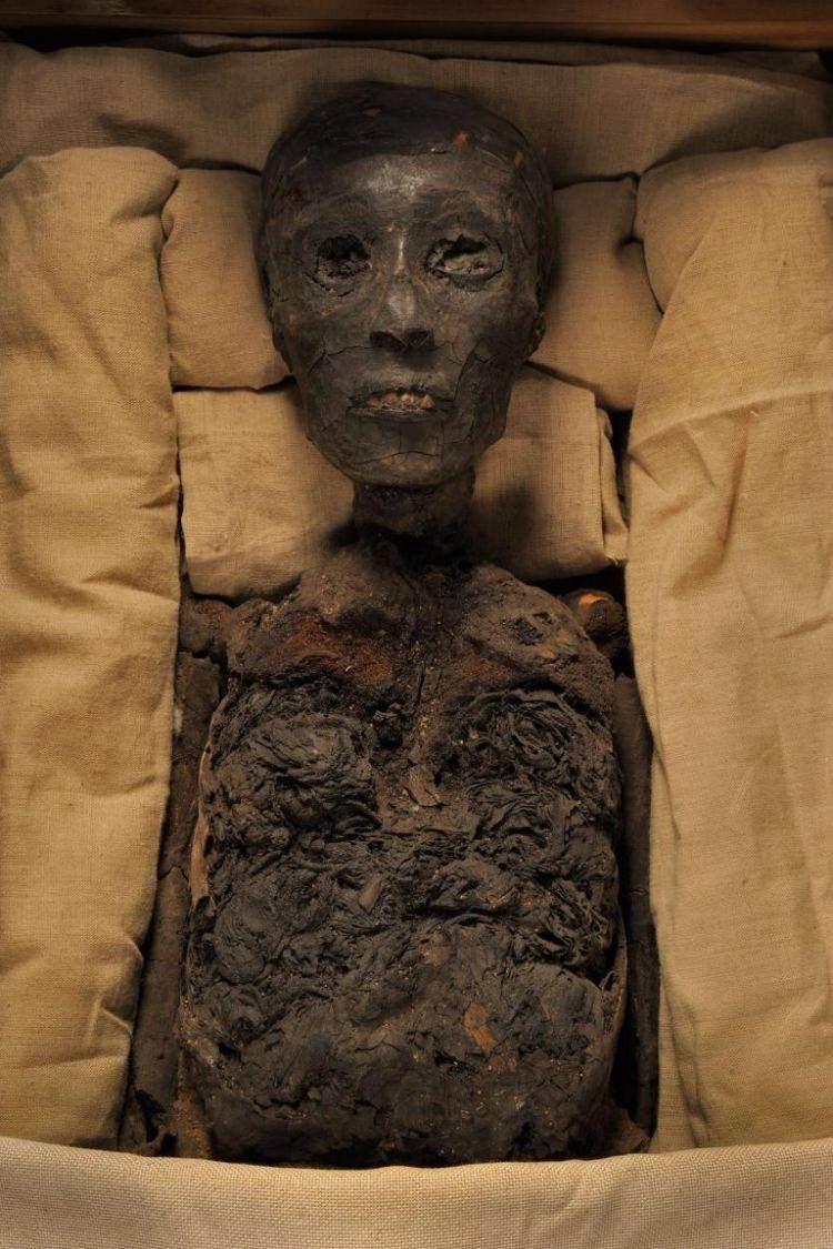 <p><strong>Tutankhamun</strong></p>
<p><br />
Antik Mısır’ın en ünlü firavunu, kardeşler arası birleşmeden dünyaya gelmişti. Akraba evliliği, çarpık ayak özrüyle doğmasına yol açmış ve olasılıkla aynı babadan kardeşi de olan karısıyla bir çocuk yapmasını engellemiş olabilir.</p>