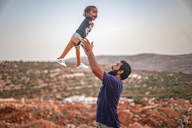 <p>Suriye'nin İdlib ilinden İçişleri Bakanı Süleyman Soylu'nun talimatıyla Türkiye'ye getirilen, doğuştan bacak ve kolları olmayan 15 aylık Muhammed bebek, protez bacaklarıyla İdlib'e döndü.Ailesiyle 1 Eylül'de Türkiye'ye getirilen İdlibli Muhammed bebek, Ankara'da gerekli tetkiklerin ardından protez bacaklarına kavuştu.</p>

<p> </p>

