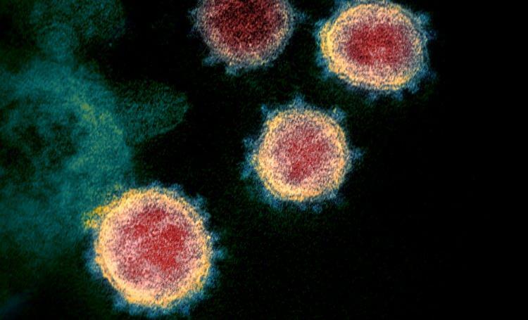 5 bin koronavir&uuml;s hastası incelendi! Korkun&ccedil; ger&ccedil;ek ortaya &ccedil;ıktı