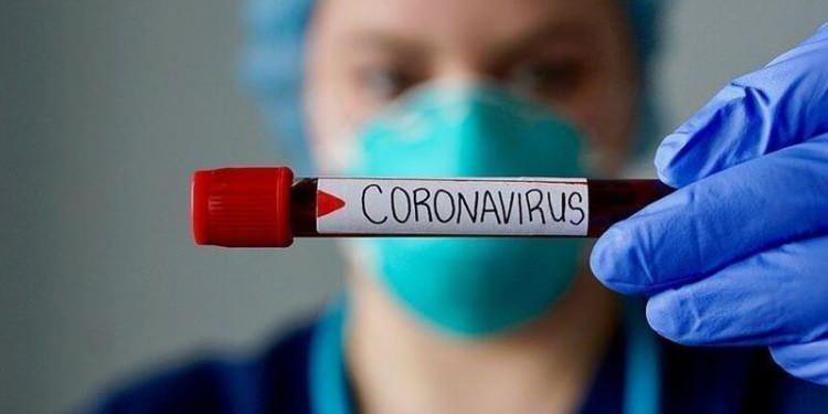 <p>Tüm dünyada korkuya sebep olan koronavirüs yayılmaya devam ediyor. Ülkemizde de görülmeye başlayan koronavirüse ünlü isimler arasından da yakalananlar oldu. İşte o isimler...</p>
