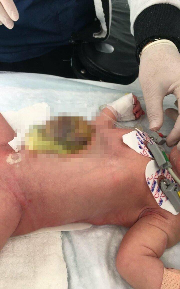 <p>Mersin&rsquo;de yaşayan 2,5 yıllık evli İltaş &ccedil;ifti, d&uuml;nyada milyonda bir bebekte rastlanan bir anomaliyle neye uğradıklarını şaşırdı.</p>
