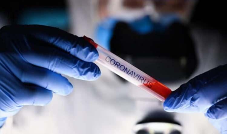 ABD'de şoke eden koronavir&uuml;s gelişmesi! 'A&ccedil;ık&ccedil;a bir şeyler oluyor'