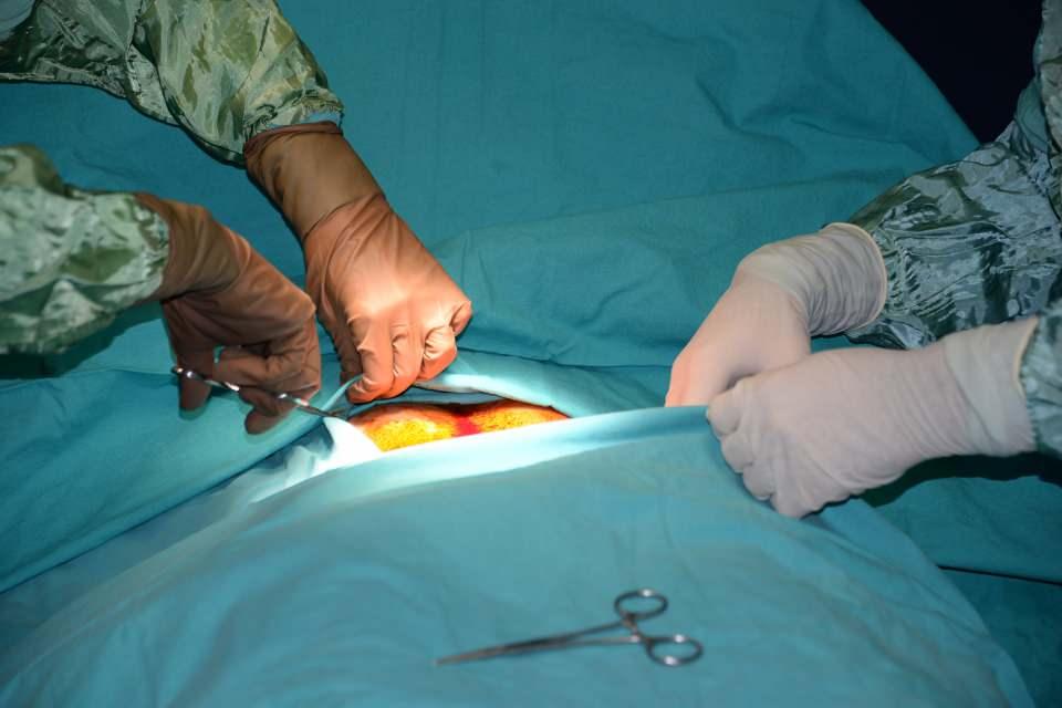 <p><strong><em>Operasyonun toplamda 1,5 saat sürdüğünü aktaran Prof. Dr. Karaman, şöyle konuştu:</em></strong></p>
<p>"Bu hastamıza kök hücre tedavisi uygulayacağız. Kök hücre tedavisini özetle söylemek gerekirse, hastanın göbek bölgesinde çok yetenekli kök hücreler bulunuyor. Bütün insanlarda göbek bölgesinde çok yetenekli kök hücreler bulunur. Biz bu kök hücreleri küçük bir operasyonla kapalı yöntemle lokal anestezi altında, narkoza gerek olmadan 15-20 dakika süren bir operasyonla yaklaşık bir su bardağı kadar almak bizim için yeterli. </p>