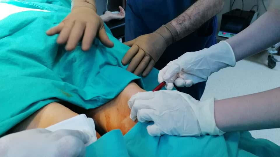 <p>Bu ispatlı bir şekilde elimizde kanıtlarıyla mevcuttur. Biz tabi bunları hastalara, tüm Türkiye'ye ulaştırmak istiyoruz, çünkü gerçekten güzel bir işlem."</p>
<p> </p>
