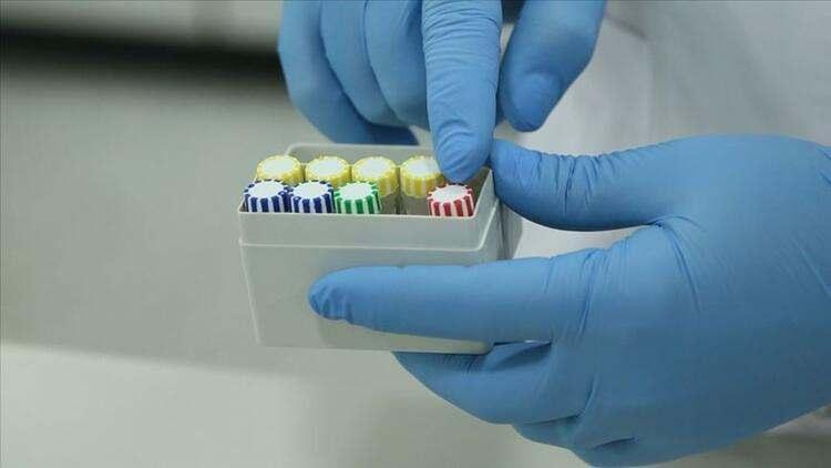 <p><strong>- Antikor testi yaptırıp tatmin olmayanlar, aşı olup ‘antikorum yok’ diyenlere yönelik doğru test yöntemlerini anlatır mısınız? </strong></p>
<p>“Antikor testi yaptırmak adeta moda haline geldi. Ancak çoğu vatandaşımız doğal olarak bu ölçüm ve testlerin sadece adını biliyor. Virüse karşı antikor yanıtı olup olmadığını anlamak için koşul, test kitinin nötralizan yani virüsü bloke edecek antikorların varlığını gösterip göstermeme özelliğidir.</p>