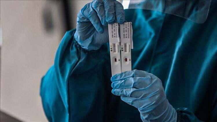 <p>Birçok kişi titrasyon yani bir değer vermeyen antikor testlerini yaptırıp neticede, baktırdığı test sonucu hakkında fikir sahibi olamıyor veya çelişkide kalıyor. Bir de hızlı test dediğimiz 10 dakika içinde sonuç veren Kovid-19 test kitleri vardır. Ancak bu testlerin de yanılgı payının daha yüksek olabildiği unutulmamalı.”</p>
<p> </p>
