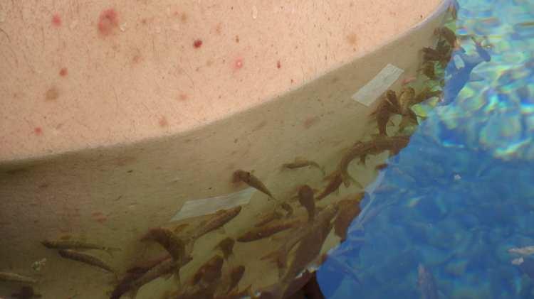 <p>Kangal ilçesine 13 kilometre uzaklıkta bulunan “Kangal Balıklı Kaplıca” dünyada sadece burada bulunan doktor balıklarıyla dikkat çekiyor. Şifa bulamayan sedef, egzama gibi cilt hastaları, 37 derecelik sıcaklıktaki selenyumlu suda doktor balıkların dokunuşları ile şifa buluyor. Dünyanın dört bir yanından şifa arayan cilt hastaları, Sivas’a gelip doktor balıkları ziyaret ediyor. Hastalar burada 1 hafta gibi kısa bir sürede şifa bulabiliyor.</p>

<p> </p>
