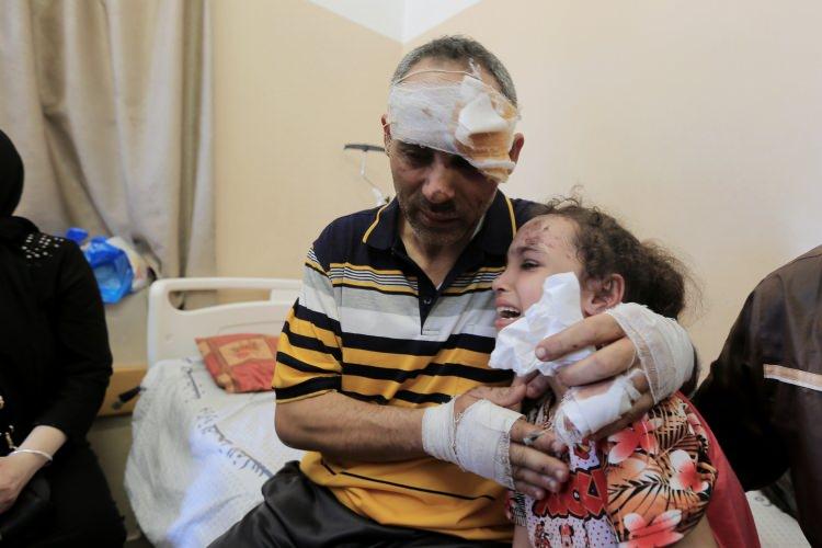 <p>“DUYDUĞUM TEK ŞEY KARDEŞLERİMİN ÇIĞLIĞI”</p>
<p>İsrail bombardımanında annesini ve 4 kardeşini kaybeden Suzi’nin babasına kavuştuğu an duygusal anlara neden oldu. Demirören Haber Ajansı’na (DHA) konuşan Suzi, “Her yer karanlıktı. Duyduğum tek şey kardeşlerimin çığlıkları” diye konuştu.</p>