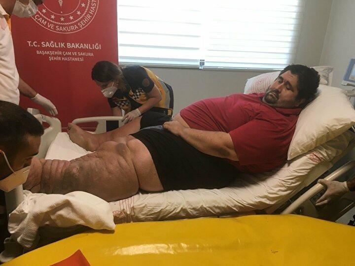 <p>Hastanın birçok hastane tarafından reddedilmesi sonrası başarılı bir operasyonla şu an durumunun iyi olduğunu ifade eden Peker, "Elimizi taşın altına sokabiliriz diye düşündük. Geldiğinde nefes nefeseydi, hiç hareket yok. Kalp atım hızı 120'lerin üzerinde, genel durumu bozuk, kan tahlili bile zor yapabildiğimiz, damar yolunu zor bulabildiğimiz bir hasta. Endoskopi için bile anestezist arkadaşlarımızla görüştüğümüzde yüksek risk verildi. Çünkü gerçekten solunumu sıkıntılıydı. Biz hasta yakınlarıyla da görüştük. Riskli bir işlemdi, kazasız belasız atlattık. Sonuçta baktığınızda bir endoskopi işlemi basit görünüyor, insanları uyutmadan yapabiliyoruz ama hastamız için yüksek riskli grubundaydı. En ufak bir anestezi aldığında solunumunun durabileceği hem anestezi hem göğüs hastalıkları tarafından ifade edildi. Bu iş multi disipliner bir iş, hiç nefes alamayan yatalak bir hastamızdı. Sadece bir balon, diyet ve ilaç tedavisiyle 15 gün içinde de 15 kiloya yakın verdirttik" ifadelerini kullandı.</p>

