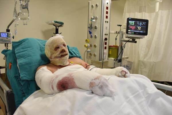 <p>Denizli’nin Buldan ilçesinde çıkan orman yangınını söndürme çalışmaları sırasında alevlerin arasında kalıp, yaralanan orman muhafaza memuru Yaşar Kozakbaş (50), Eskişehir Şehir Hastanesi yanık merkezinde tedavi altına alındı</p>