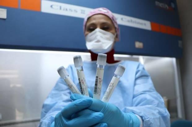 <p>- Öğretmen ve okul çalışanlarının aşı olmamaları durumunda haftada 2 kez PCR testi ile taranmaları istenecek.</p>

<p> </p>
