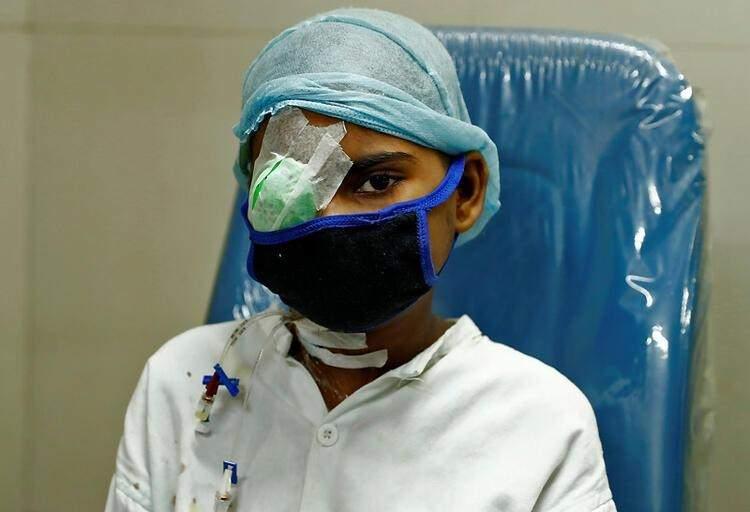 <p>Hindistan, son aylarda Delta varyantının yanı sıra 'kara mantar-mukormikoz' hastalığıyla da dünya gündemindeydi. Nadir görülen ve burun, göz ve bazen de beyni etkileyen bu agresif mantar enfeksiyonu ölümcül.</p>