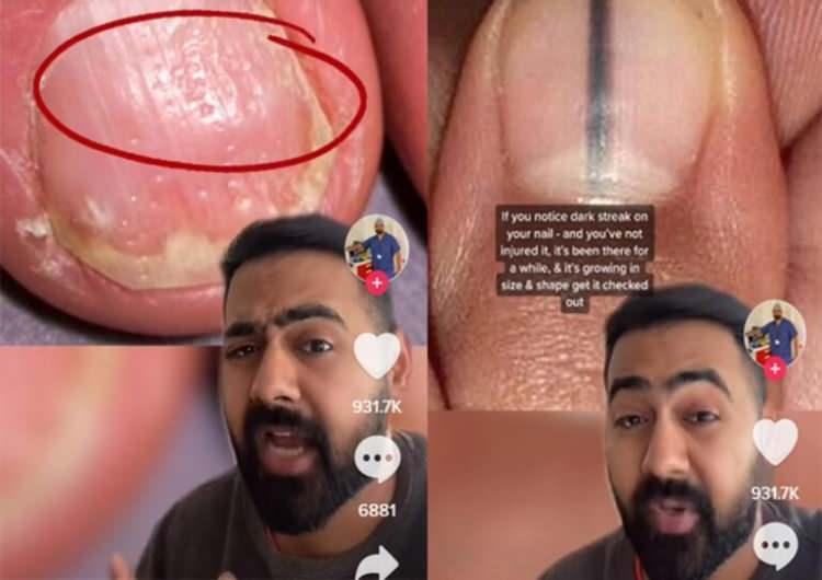 <p><span style="color:#000000"><strong>Aynı zamanda Sunderland Üniversitesi’nde öğretim üyesi olan Dr. Karan Rangarjan’ın TikTok’ta 4,2 milyon takipçisi var ve onlara her gün sağlıkla ilgili tavsiyelerde bulunuyor.</strong></span></p>

<p> </p>
