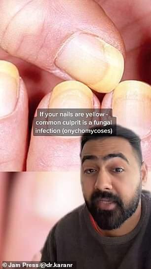 <p><span style="color:#B22222"><strong>TikTok yıldızı doktor, hemen hepimizin tırnaklarında dönem dönem oluşan bulut benzeri beyaz lekeler, boyut olarak büyüyen ve belirginleşecek koyu renkli çizgiler, çukurlar, tırnak çatlamaları ve kırılmalarının her birinin bir sağlık sorununa işaret ettiğine dikkat çekiyor.</strong></span></p>
<p> </p>