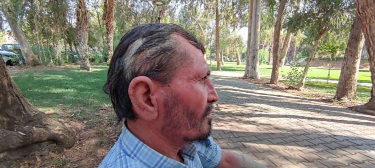 <p> Yaklaşık 2 aylık tedavi gören Sümbül'ün tedavisinde büyük başarı elde edildi.<br />
İyileştiğini düşünen ve evlenme hayalleri kuran Sümbül’ün hayalleri yeniden suya düştü. Yıllardın mücadele ettiği amansız hastalığı geri geldi. Vücudunu yeniden saran hastalık Sümbül’ü eski kabus dolu günlerine geri döndürdü.</p>
