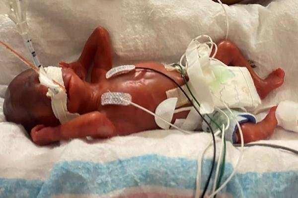 <p><strong>Amerika'da 2020'nin Temmuz ayında henüz 21 haftalıkken dünyaya gelen Curtis Means, dünyanın en erken doğan ve hayatta kalan bebeği olarak Guinness Dünya Rekorlar Kitabı'na girdi.</strong></p>
