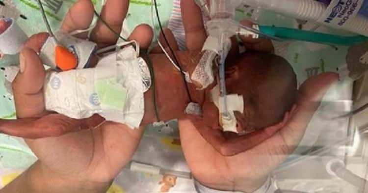 <p><strong>Geçtiğimiz sene ABD’nin Birmingham Alabama Üniversitesi Hastanesi’nde 21 haftalıkken dünyaya gelen bebek Guinness Dünya Rekorlar Kitabı’na girdi. Yalnızca 420 gram olarak doğan bebeğin dünyanın en erken doğan ve hayatta kalan bebeği olduğu aktarıldı.</strong></p>
