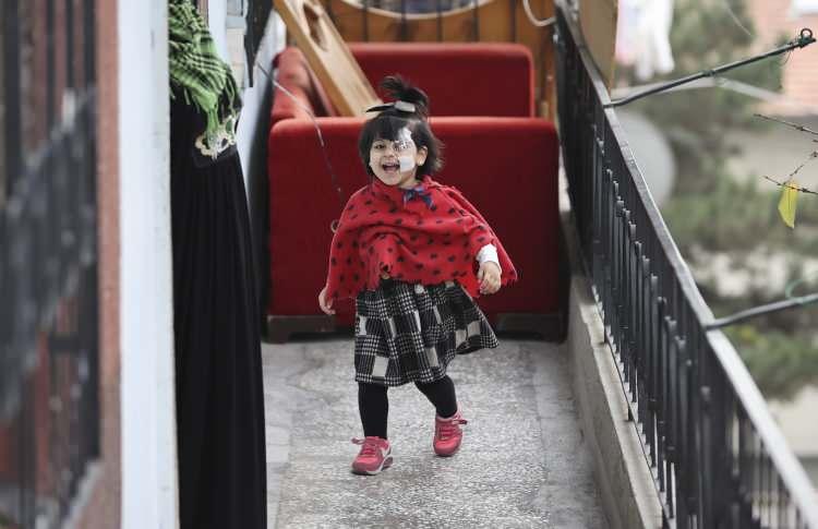 <p>&nbsp;Her iki g&ouml;z&uuml;ne de belli aralıklarla nakil ger&ccedil;ekleştirildi. Şu anda sağlığı iyi, normal &ccedil;ocuklar gibi oyun oynayabiliyor ve yaşamına devam edebiliyor. Bu da hastamız ve ailesi kadar bizi de mutlu ediyor."</p>
