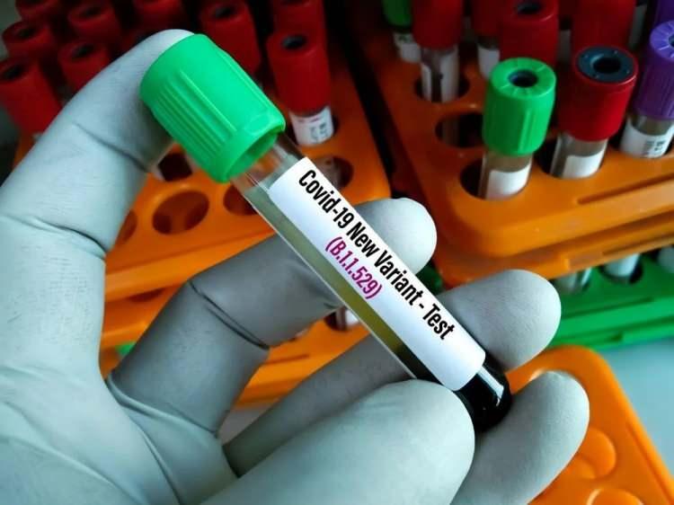 <p><strong>T-HÜCRELERİNİN KORUMASI VARYANTI AYIRT ETMEKSİZİN DEVAM EDER</strong></p>

<p>Bununla birlikte, tüm bu değişikliklere rağmen, daha önceki enfeksiyona veya aşılamaya yanıt olarak oluşan T hücrelerinin varlığının göz ardı edilmemesi gerekiyor. </p>

