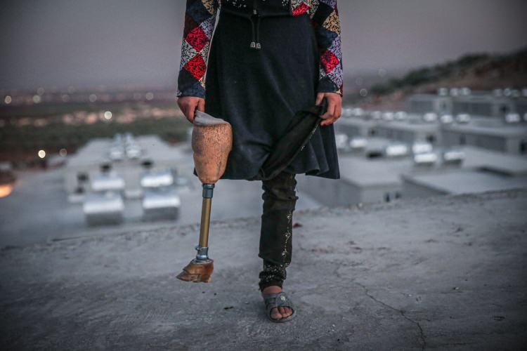 <p>Bessüs, "Hayalim, protez bir bacağımın olması ve okula gidebilmek. Büyüyünce de öğretmen olmak istiyorum. Kendimi bildim bileli ayağım yok." dedi.</p>
