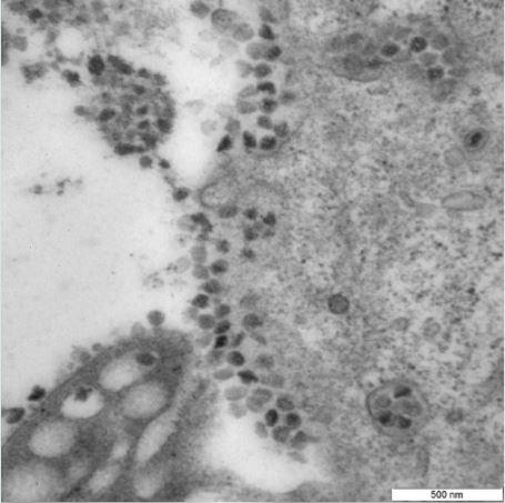 <p>Vektor Devlet Viroloji ve Biyoteknoloji Bilim Merkezi laboratuvar ortamında Vero E6 hücre kültürünü Omicron ile enfekte etti. Bu sırada Omicron varyantının şekil, boyut, yüzey yapısı gibi özelliklerini incelenmesi amaçlandı.</p>
