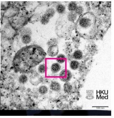 <p>Dünya Sağlık Örgütü (DSÖ) tarafından 'B.1.1.529' adıyla tanımlanan ve 'endişe verici' olduğu vurgulanan Omicron'u inceleyen Hong Kong Üniversitesi'nden bilim insanları, varyantın elektron mikroskobu altındaki görüntülerini yayımlamıştı.</p>
