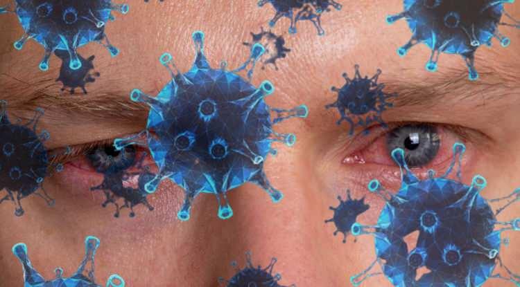 <p><strong>Koronavirüs ve varyant kabusu bitmeden kışın artan solunum hastalıklarından biri daha yaygınlaştı. Son günlerde hastaneye göz kızarıklığı ve ağrısı şikayetleriyle başvuran kişilerin sayısı arttı. Solunum yolu hastalıklarına yol açan adenovirüs, göz içinde ciddi enfeksiyonlara neden oluyor.  Görme kaybına yol açan adenovirüs nedir?  Adenovirüs tedavisi var mıdır?</strong></p>
