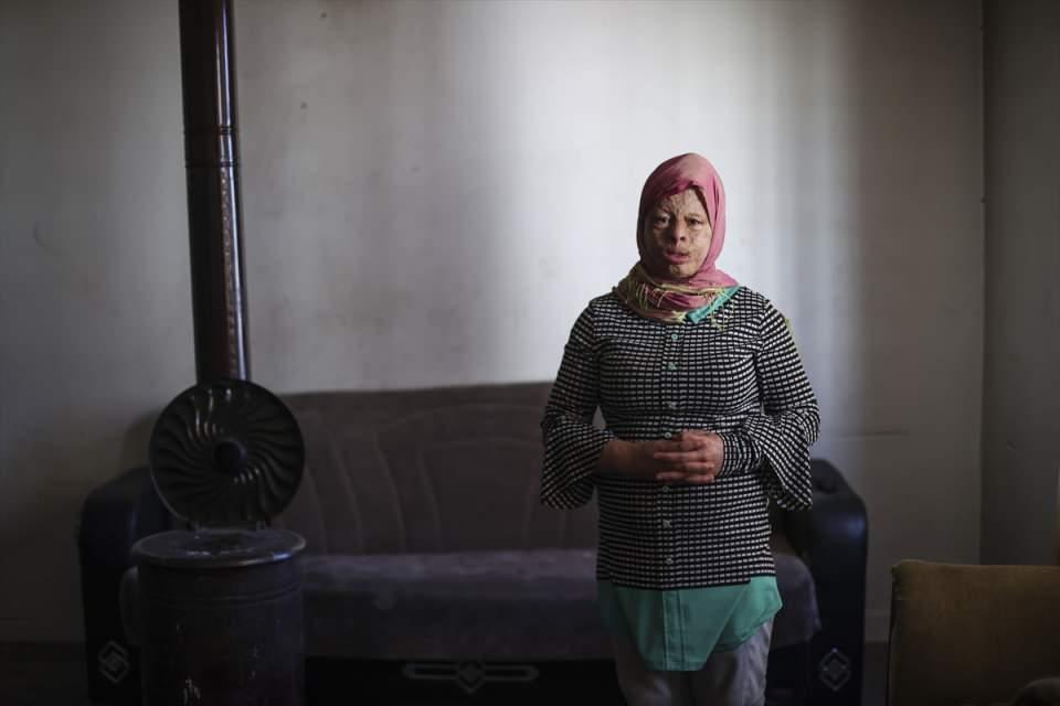 <p>Ziyarete giderken yanında oyuncak da götürdüğünü ancak Emine'nin oyuncaklarla hiç ilgilenmediğini ifade eden Aksu, şunları anlattı:</p>
<p>"Emine, babasının telefonundaki bir çocuğu gösterdi. Fotoğraftakinin kardeşi ya da arkadaşı olduğunu düşünmüştüm. 'Bu benim' dedi. Emine, gözünü açıp kapatamıyordu, yeniden gözünü açıp kapatmak istediğini söyledi. </p>