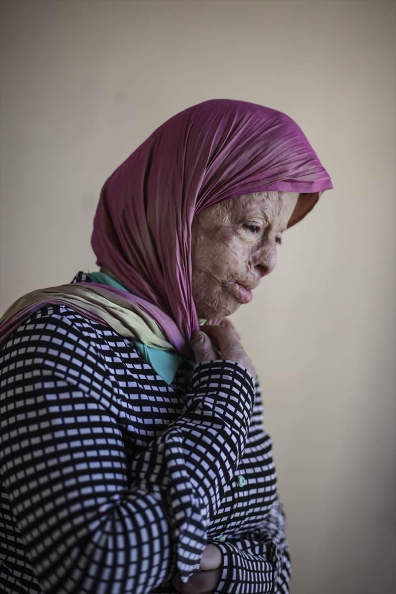 <p>Dernek Başkanı Ayşegül Aksu, AA muhabirine, dernekleşmelerinin hikayesinin Emine İsmail'le başladığını söyledi.</p>
<p> </p>