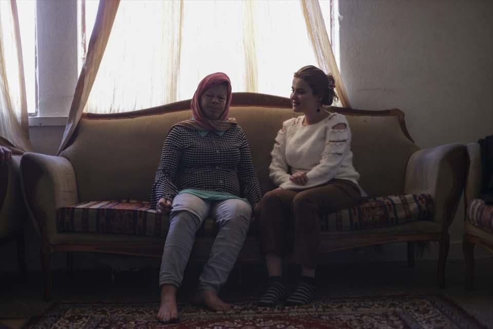 <p>Kızımızın iyi olması için yeni ameliyatların olmasını istiyoruz." diye konuştu.</p>