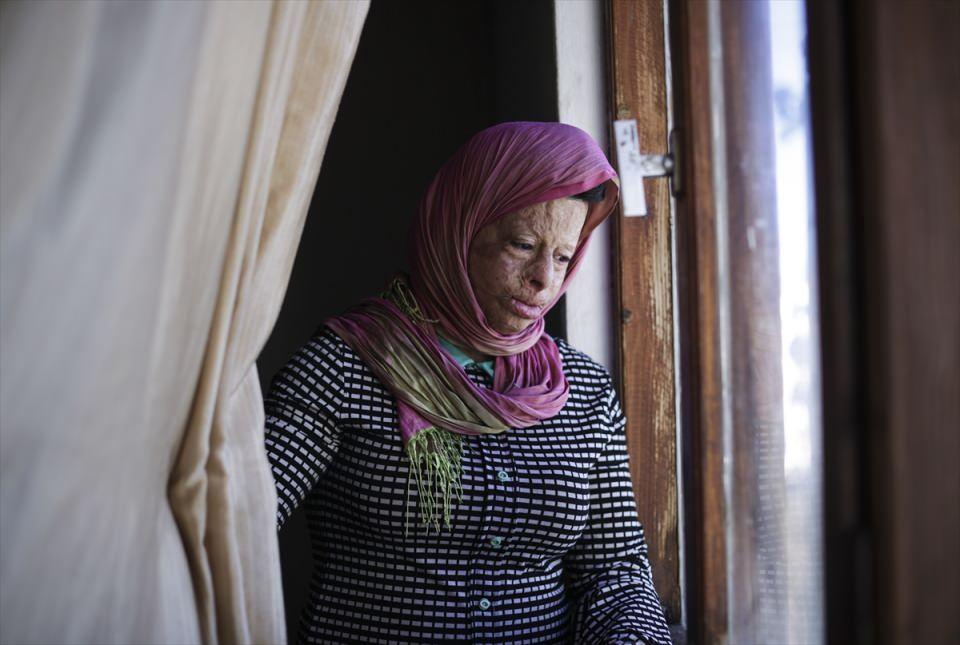 <p>O zaman 'Benim Emine ile ilgilenmem lazım' dedim ve aradan 7 yıl geçti. Emine ve diğer çocuklarla bu süreçte tanıştım."</p>
<p> </p>