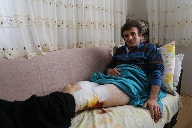 <p>Artvin’de işitme engelli 36 yaşındaki Ersin Karadeniz köyünden, mezra evininin damını temizlemek için ormanlık alandan geçtiği sırada ayı saldırısına uğradı.</p>
