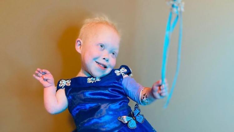 <p><span style="color:#800080"><strong>Doğduktan kısa bir s&uuml;re sonra birka&ccedil; farklı genetik hastalığa sahip olduğu teşhis edilen Bella Thompson, yaşamı boyunca 21 ameliyat ge&ccedil;irdi, 4 farklı hastanede 800 g&uuml;nden fazla kaldı.</strong></span></p>

<p>&nbsp;</p>
