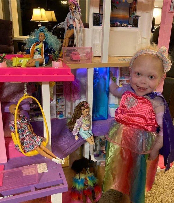 <p><span style="color:#800080"><strong>Bella'nın sağlık sorunları, sadece &uuml;&ccedil; g&uuml;nl&uuml;kken, Kyla ve Lyle'a yeni doğan bebeklerinde bağırsak par&ccedil;alarının &ouml;ld&uuml;ğ&uuml;, "Hirschsprung" adlı bir bağırsak hastalığı olduğu s&ouml;ylendiğinde ortaya &ccedil;ıktı. Bu teşhisi bir dizi ameliyat takip etti. Ancak 11. ayda, Bella'nın ebeveynlerine, aynı zamanda, şiddetli kombine imm&uuml;n yetmezlik (SCID) olarak bilinen ve sadece soğuk algınlığına yakalanmaktan &ouml;lebileceği anlamına gelen kronik bir bağışıklık rahatsızlığı olduğu s&ouml;ylendi. Daha k&uuml;&ccedil;&uuml;c&uuml;k bir bebekken, hastanede iki ay tecritte kalmak ve kemik iliği nakli olmak zorunda kaldı. Bu s&uuml;re zarfında Bella'ya aynı anda kıkırdak kılı hipoplazisi teşhisi kondu.</strong></span></p>
