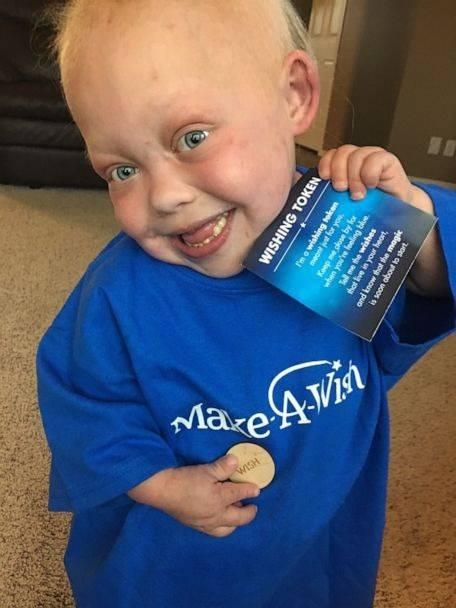 <p><span style="color:#800080"><strong>T&uuml;m bu zorlu m&uuml;cadeleye rağmen Bella, pozitif ve mutlu bir &ccedil;ocuk hayatına devam ediyor. &Uuml;stelik bu neşe dolu tavrı bir sosyal medya yıldızı olmasını sağladı. İlham verici videoları ile tam 4,5 milyon takip&ccedil;iye ve 96 milyondan fazla beğeniye ulaşmasını m&uuml;mk&uuml;n kıldı. Hayranları tarafından "Bella the Brave" (Cesur Bella) olarak adlandırılıyor</strong></span></p>

<p>&nbsp;</p>
