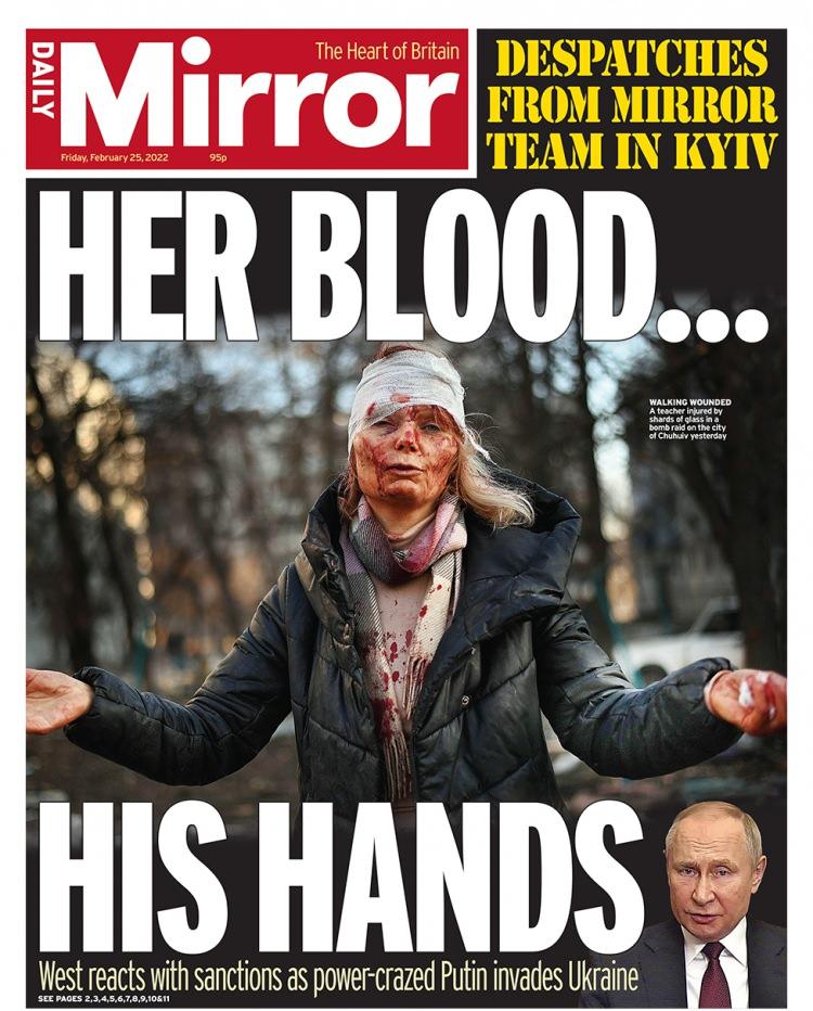 <p>Daily Mirror gazetesi de yaralanmış kadının ellerini iki yana açmış fotoğrafının hemen altına, "güç delisi" benzetmesini yaptıkları Rus lider Putin'in fotoğrafını yerleştirdi ve "Onun kanı, onun ellerinde" diye yazdı. Gazete, söz konusu kadının Chuhuiv şehrinde yaralanmış bir öğretmen olduğunu bildirdi.</p>

<p> </p>
