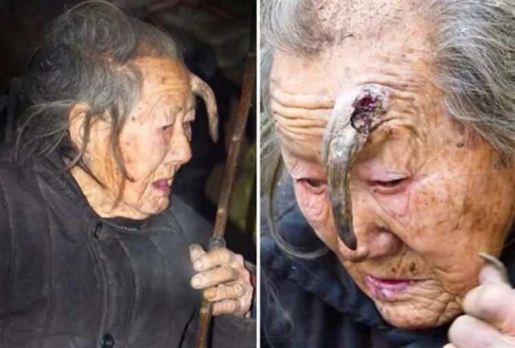 <p>Çin'de yaşayan kadının son hali görenleri epey şaşırttı.</p>
<p> </p>