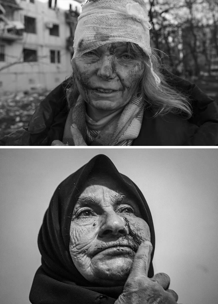 <p>Suriye'deki iç savaşın boyutlarını anlatan ve hafızlarda yer eden fotoğraf karelerinin benzerlerine, Ukrayna savaşında da rastlanıyor.</p>

<p> </p>

