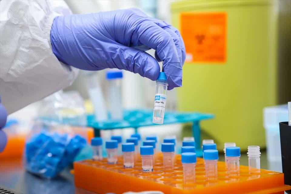 <p>Akdoğan, ismini "TÜSEB DiaKit" koydukları kitin, Türk Patent ve Marka Kurumu tarafından marka tescili yapılmış ve kamuda üretilmiş bir ürün olarak ortaya çıktığını belirtti.</p>
