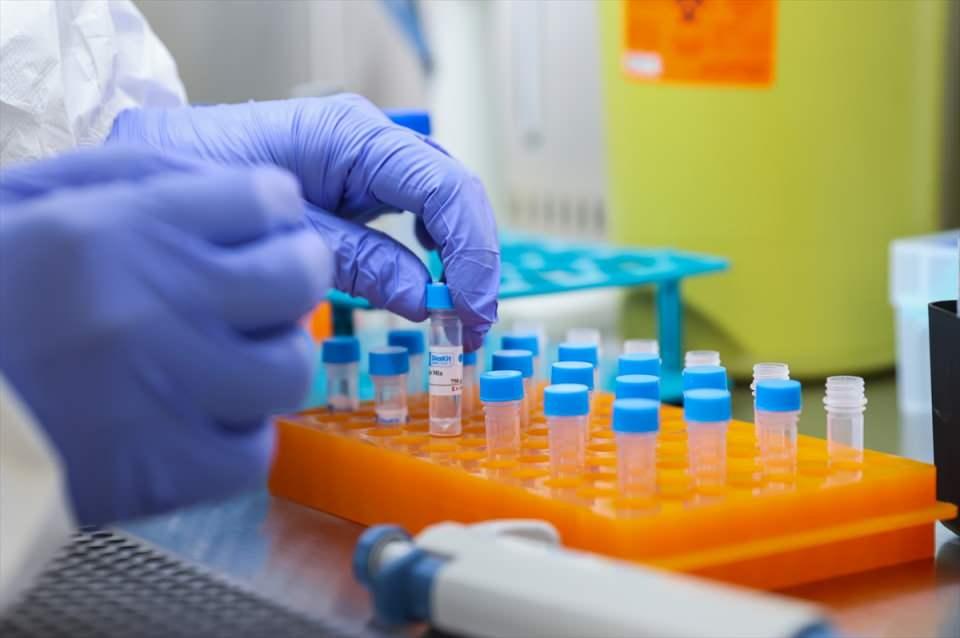 <p>TÜSEB Başkanı Prof. Dr. Erhan Akdoğan da kit ile ilgili açıklamalarda bulundu.</p>

<p> </p>

