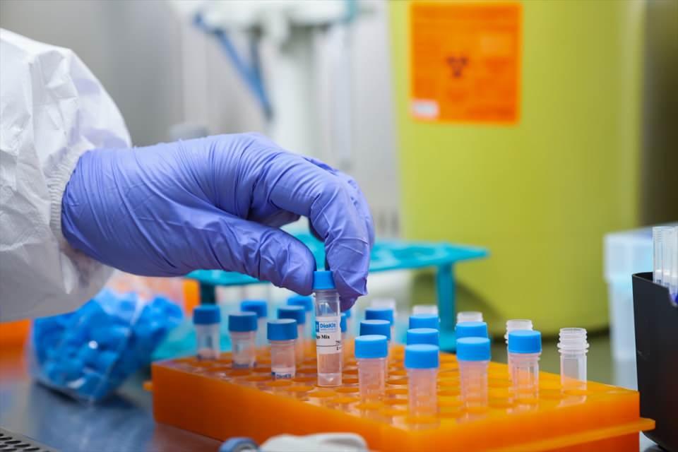 <p><strong>Kamuda üretilmiş ve ruhsatlandırılmış ilk Kovid-19 tanı kiti</strong></p>

<p>Prof. Dr. Akdoğan, salgın süreci yavaş yavaş nihayete erse de gelecekteki pandemilere Ar-Ge açısından hazırlıklı olunması ve Kovid-19'un grip gibi seyredeceği düşüncesinden hareketle bu tanı kitini geliştirdiklerini anlattı. </p>
