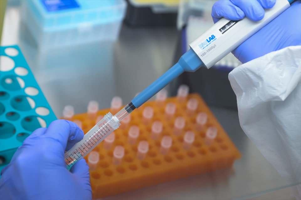 <p>Yeni nesil Kovid-19 tanı kiti "TÜSEB DiaKit", hastaların burun ve boğazından alınan örneklerinde virüs olup olmadığının tespit edilmesini sağlıyor. </p>

<p> </p>
