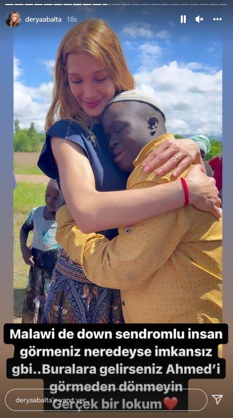 <p><strong>Afrika'da down sendromlu insanları görmenin nadirliğinden bahsederken Balta, "Buralara gelirseniz Ahmed'i görmeden dönmeyin, gerçek bir lokum" notuyla takipçilerine sundu.</strong></p>
