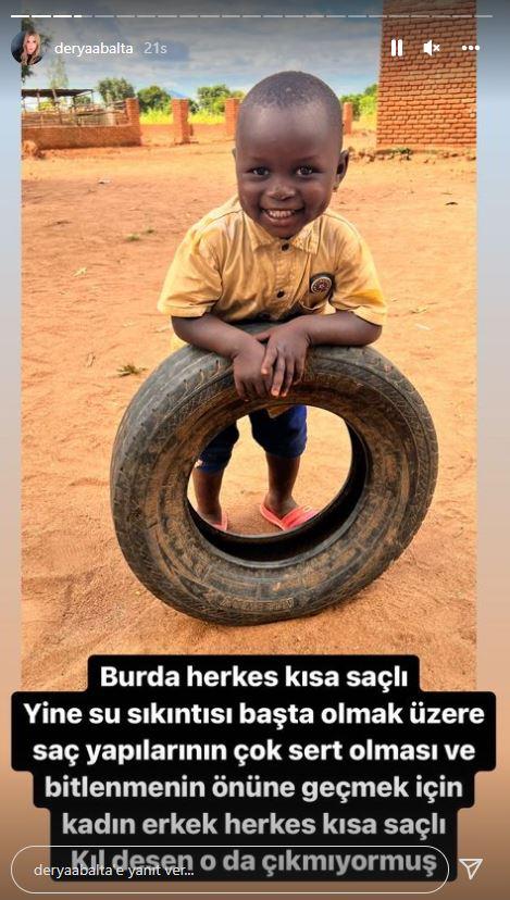 <p><strong>Bölge hakkında bilgiler vermeye devam ederken Balta, burada herkesin kısa saçlı olmasının sebebini su sıkıntısı başta olmak üzere, saç yapılarının sertliği ve bitlenme problemlerinden ötürü olduğunu açıkladı.</strong></p>
