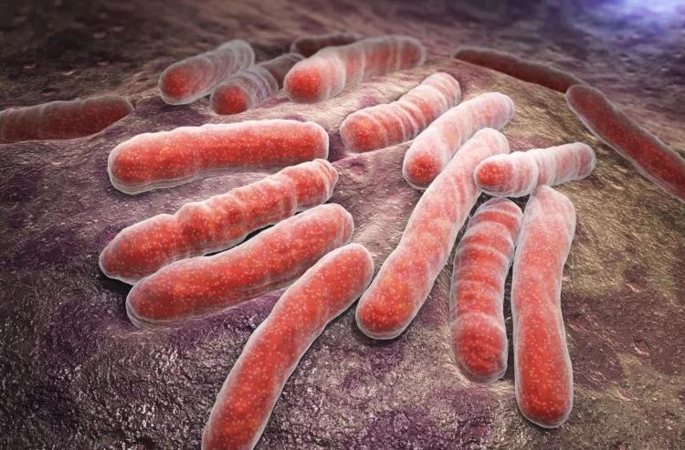 <p><strong>Organ kayıplarına yol açan bakteri hakkında Sakarya, ciddi uyarılarda bulunmaya devam etti. Ölümcül olabileceğini hatırlatan ünlü doktor, yerleştiği organı bitiren bakterinin vücuttan hızla atılmasının zor olduğunun altını çizdi. </strong></p>
