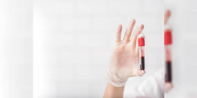 <p>Bilim insanları, kan grupları hakkında önemli bir çalışmaya imza attı. Araştırmaya göre AB kan grubundaki kişilerin bunama ve kanser hastalığına karşı daha savunmasız olduğu tespit edildi.</p>

<p> </p>
