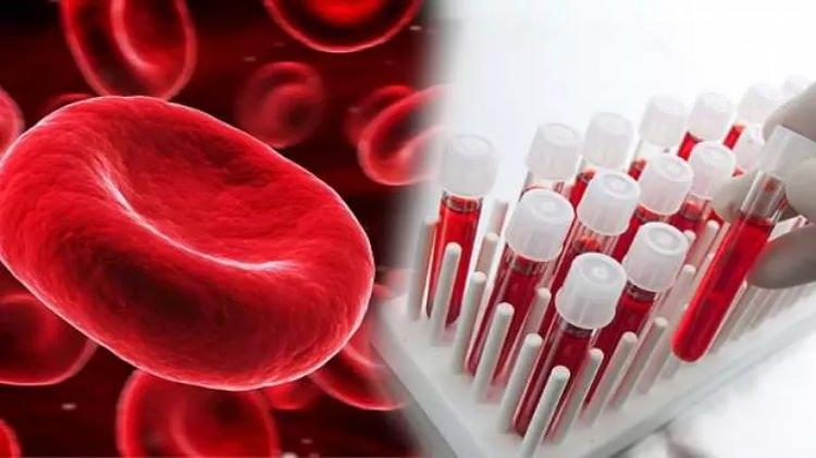 <p><strong>YÜZDE 82 DAHA YÜKSEK ÇIKTI</strong></p>

<p>Araştırmaya göre AB kan grubuna sahip kişilerin, diğer kan gruplarına sahip kişilere göre bunamaya yakalanma riski yüzde 82 daha fazla çıktı. </p>
