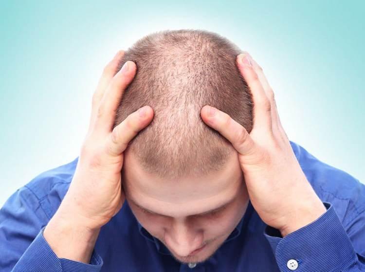 <p>FDA’nın Olumiant’ı onaylamasına yol açan klinik deneylerde, ilacın ciddi alopesili kişiler için güvenli ve etkili olduğu keşfedilmiş. Fakat tüm ilaçlarda olduğu gibi aralarında karın ağrısının, üst solunum yolu enfeksiyonlarının ve kilo alımının bulunduğu bazı yan etkiler barındırıyor.</p>
