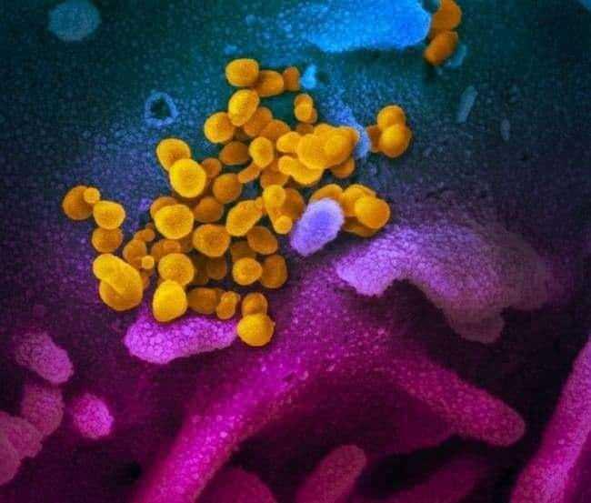 <p>Imperial College London'dan React-1 araştırmacıları, bu varyantta koku ve tat kaybının en az görülen belirtiler olduğunu kaydetti. Bunun yerine hastalar daha çok grip benzeri semptomlar bildirdi.</p>